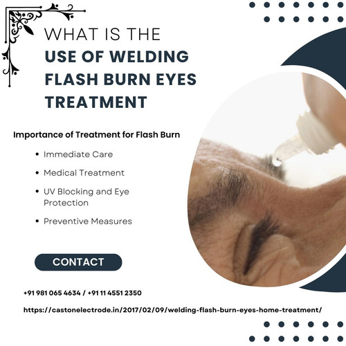 What is the Use of Welding Flash Burn Eyes Treatment.jpg