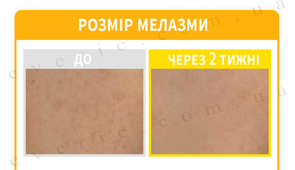 03 03 копия