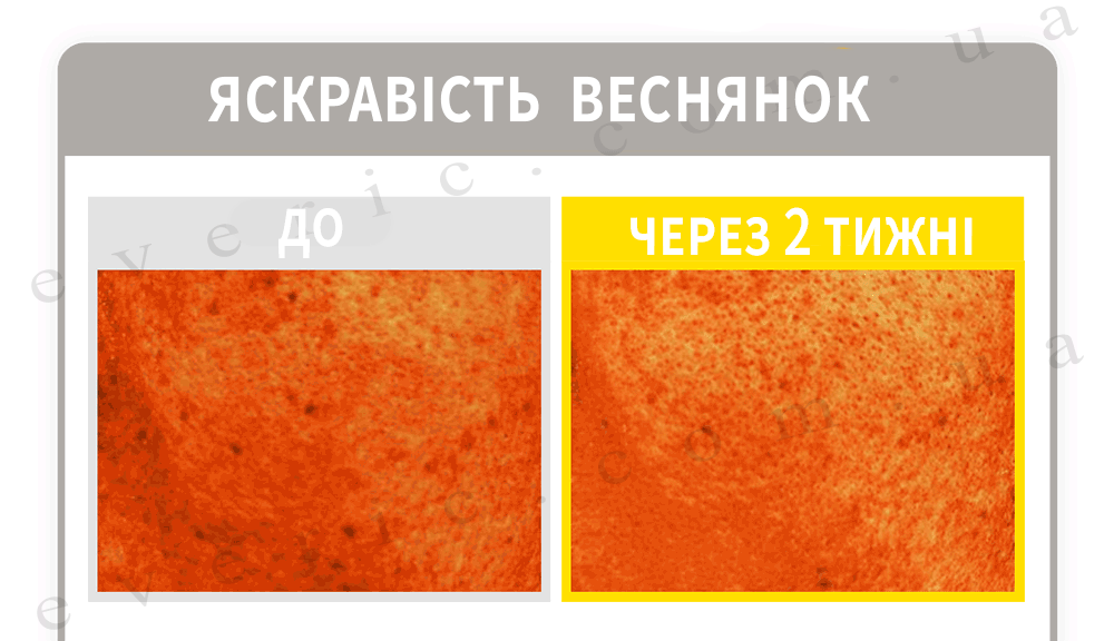 03 05 копия