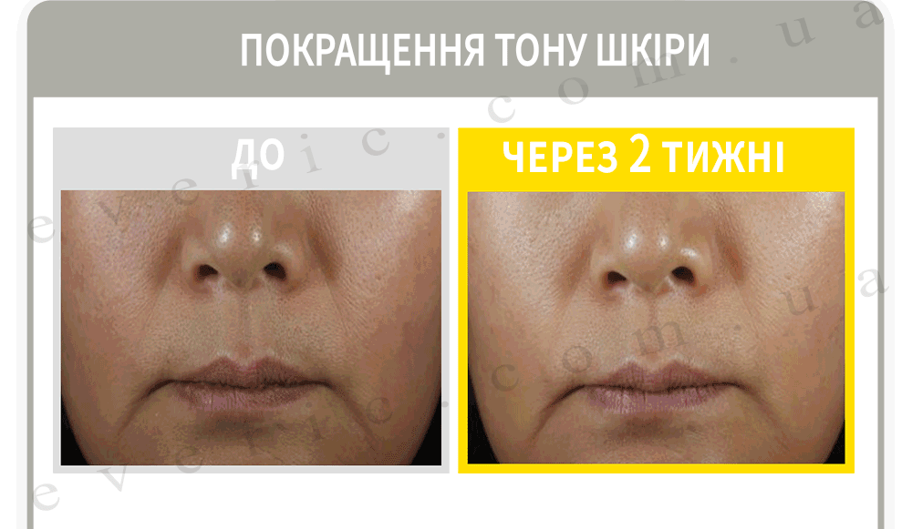 03 07 копия
