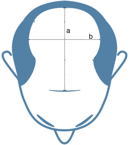 How can I know the toupee size I need4.png