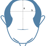 How can I know the toupee size I need4