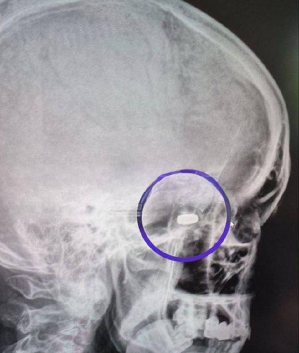 ITTfoxsVEzVmqPetFCi2p0hiHf1roXac3t4 53zu9JRWtca5nYNhu 56h9KAWBJ7wPqhZR2w6JjdvMeMC tj9rDl7jZwNOJ6FD2U.jpg