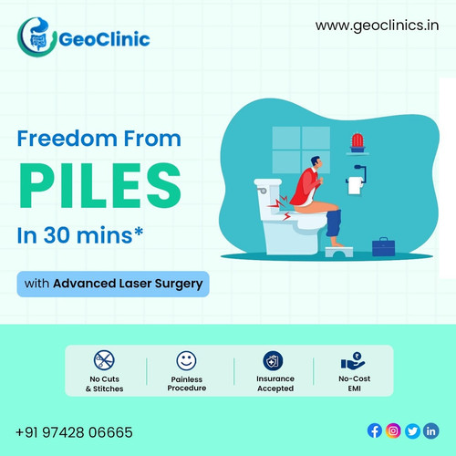 Best Piles Treatment Doctors In Bangalore - Geoclinics.in.jpg