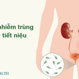 tietnieu2401