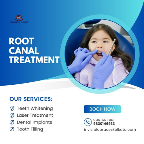 Get the Best Root Canal Treatment in Kolkata with Advanced Technology.jpg