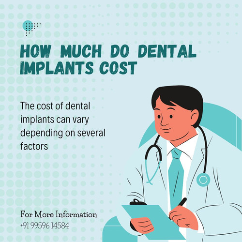 How Much Do Teeth Implants Cost.jpg