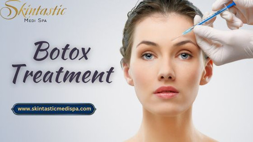 Botox Treatment CA.1