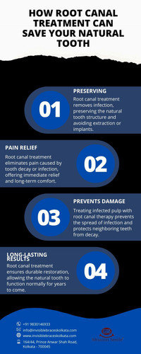 How Root Canal Treatment Can Save Your Natural Tooth.jpg