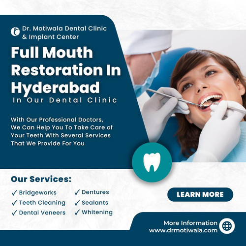Full Mouth Restoration In Hyderabad.jpg