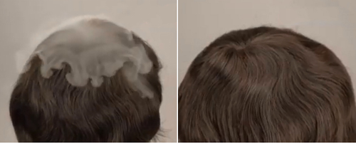 How does hair systm breathability impact on your choice of toupee1.png