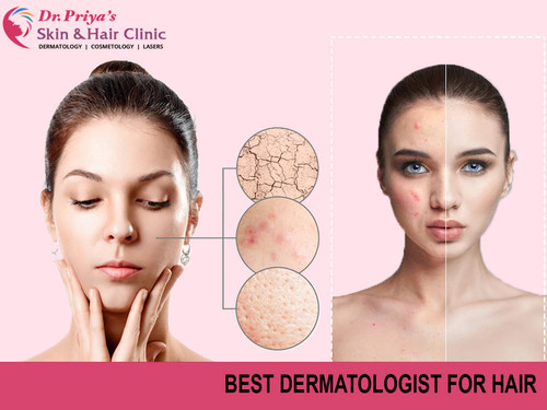 Best Dermatologist In Bangalore For Hair.jpg