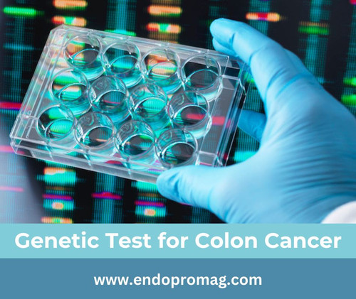 The Importance of Genetic Test for Colon Cancer.jpg