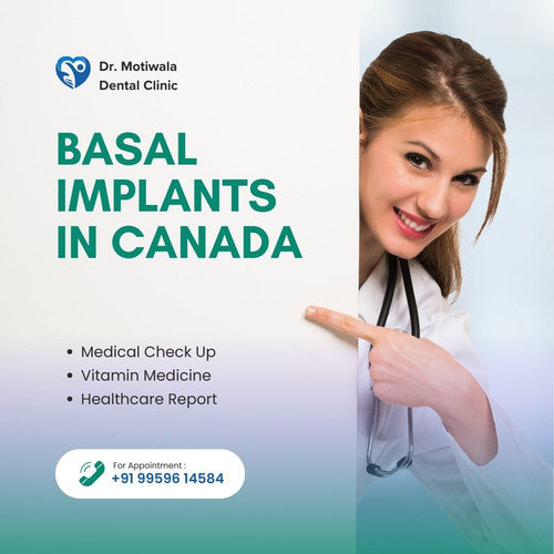 Basal Implants In Canada.jpg