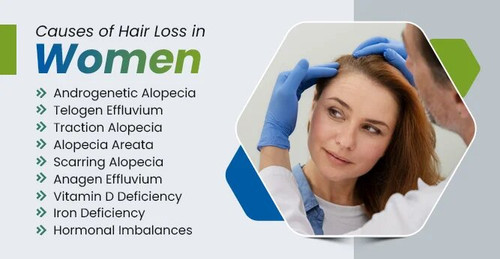 Causes of Hair Loss in Women | Celebre.jpg