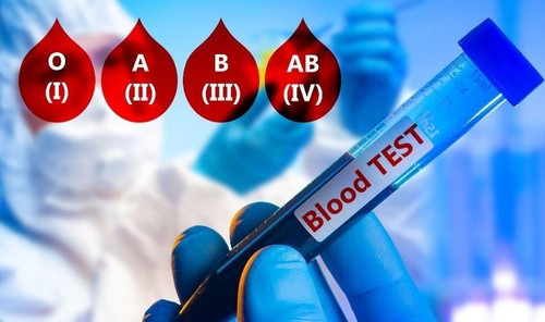 diOIB9a.md.jpg