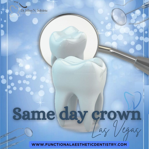 Same day crown Las Vegas.jpg