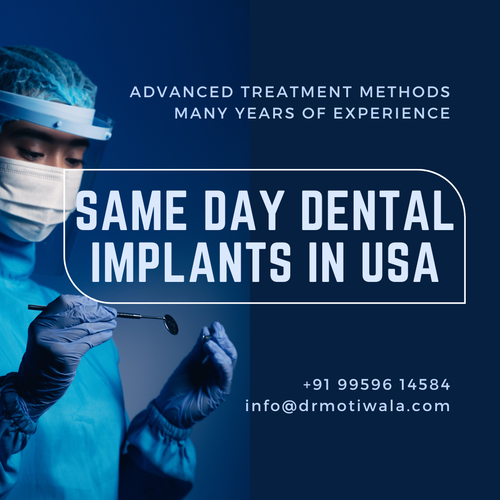 Same Day Dental Implants In Usa.png