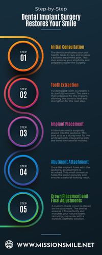 Step by Step How Dental Implant Surgery Restores Your Smile.jpg
