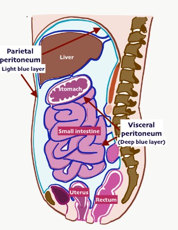 Peritoneal Cancer Treatment.jpg
