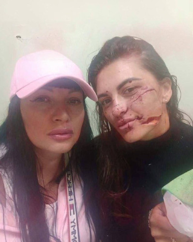 MaaZLuRq7r8NddssrRXYRw4QSqQaF5dOhCHR jqH84BPmTVCBFCDtxgEEA aVEJrJHgx2x0Fv4I6wnwwcvyek dRWLsVOVl5hy3 .jpg