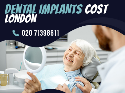 dental implants cost London.jpg