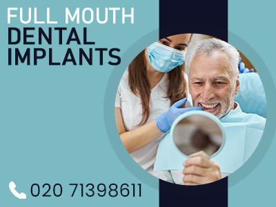 full mouth dental implants.jpg