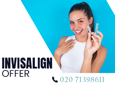 Invisalign offer.jpg