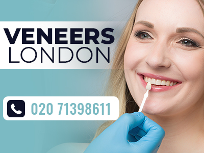 Veneers London.jpg