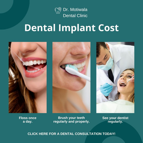 Dental Implant Cost.jpg