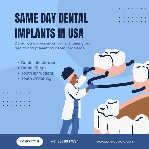 Same Day Dental Implants In Usa.jpg
