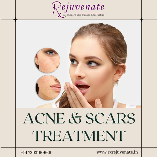 Best Skincare Clinic in Delhi.jpg