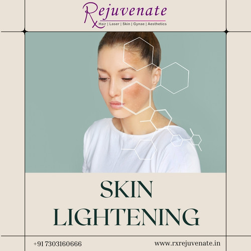 Best Skincare Clinic in Delhi (22).jpg