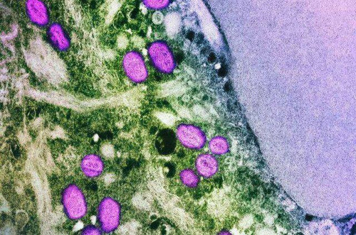 rKfeRcXW4t4L4LbbTrGpSvvzOKj2GZO rbqcFZiHWZbcWC8bTVyppjuyuhk ZqanmJOInPkrs8ApgKhL69TSVGHy5yEH3sqR2 WQ.jpg