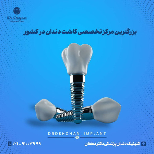 HNISAAwZPX cvs h4z5RPsehd1WODJil By2g44efP0yNvvbxmEpCFp90yNGTDDWrxO5MXgF5KNQg0Hn7CgKy9RrqXpcdgL3ZSLO.jpg