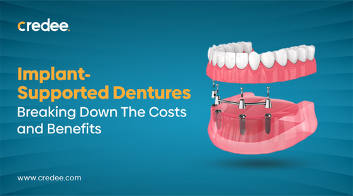Implant Supported Dentures.jpg