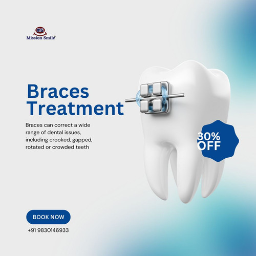 Advanced Braces Treatment in Kolkata for a Confident Smile.jpg