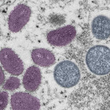 mpox2402