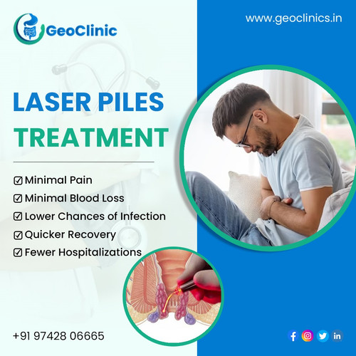Laser Piles Treatment | Geoclinics.in.jpg