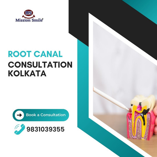 How a Root Canal Consultation Can Save Your Tooth.jpg