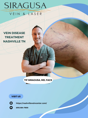 Vein disease treatment Nashville.jpg