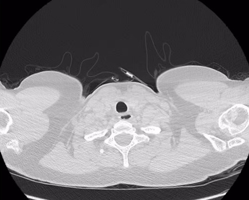 HcUz8Sc9hNn8 Nyb.jpg