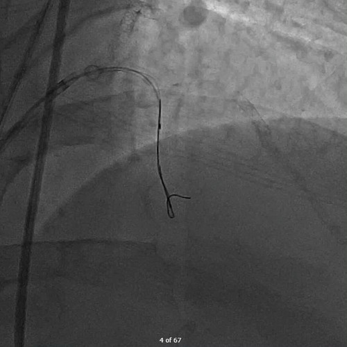 W1 omNWGJ8bxfh7Y.jpg