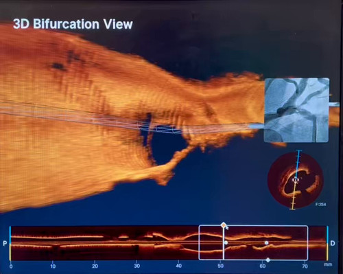 J6kPZ0dPjG WJ0Cl.jpg