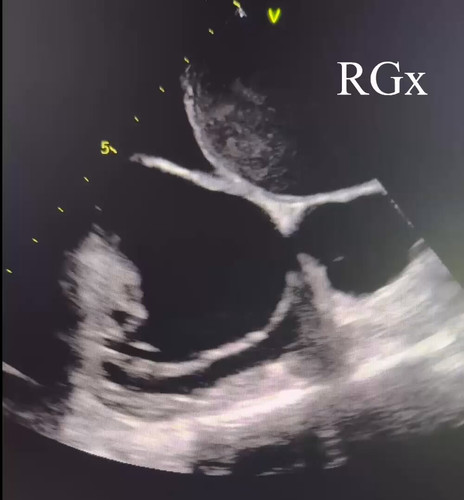 yCgss6475 PKFDcr.jpg