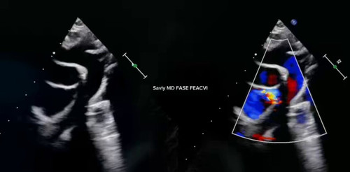 Jo6ArRscKATg 8MP.jpg