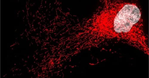 1578061424590099328?url=http%3A%2F%2Fmed.news.am%2Fstatic%2Fnews%2Fb%2F2025%2F12%2F40194.jpg&fb obo=.jpg