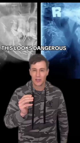 xz3yT aDaZN7p5t3.jpg