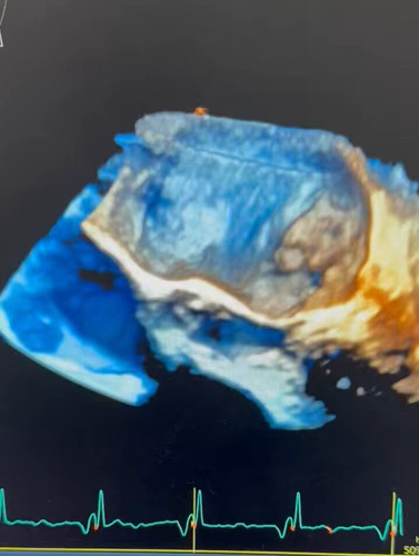 ZC256rtPhMBtjzQh.jpg