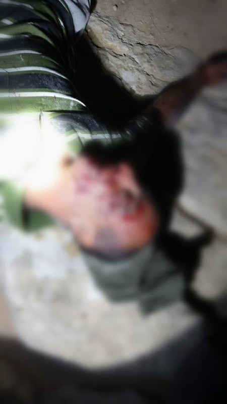 أصيب عدد من الفلسطينيين جراء هجوم واسع للمستوطنين على خربة المركز بمسافر يطا جنوب الخليل....